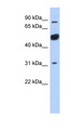 BEND2 Antibody - BEND2 / CXorf20 antibody Western blot of MCF7 cell lysate. This image was taken for the unconjugated form of this product. Other forms have not been tested.