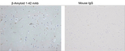 Beta Amyloid 1-42 Antibody - Immunohistochemistry analysis of human brain tissue slide (Paraffin embedded) using Human ß-Amyloid 1-42 Antibody (2C2G5), mAb, Mouse and Mouse IgG Control (Whole Molecule), Purified.