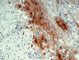 Beta Endorphin Antibody - Immunohistochemistry staining of human pituitary gland (frozen sections) with anti-human beta Endorphin (B31.15).
