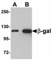 Beta Galactosidase Antibody - Western blot of (A) 5 and (B) 25 ng of b-gal with b-gal antibody at 1 ug/ml.