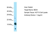 BEX4 Antibody -  This image was taken for the unconjugated form of this product. Other forms have not been tested.