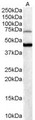 BF1 / FOXG1 Antibody - BF1 / FOXG1 antibody (0.3µg/ml) staining of Human Brain lysate (35µg protein in RIPA buffer). Detected by chemiluminescence.