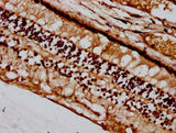 BFSP2 Antibody - Immunohistochemistry Dilution at 1:400 and staining in paraffin-embedded human eye tissue performed on a Leica BondTM system. After dewaxing and hydration, antigen retrieval was mediated by high pressure in a citrate buffer (pH 6.0). Section was blocked with 10% normal Goat serum 30min at RT. Then primary antibody (1% BSA) was incubated at 4°C overnight. The primary is detected by a biotinylated Secondary antibody and visualized using an HRP conjugated SP system.