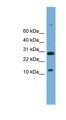 BHLHA19 / TAL2 Antibody - TAL2 antibody Western blot of Mouse Small Intestine lysate. This image was taken for the unconjugated form of this product. Other forms have not been tested.