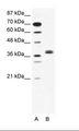 BHLHE22 / BHLHB5 Antibody - A: Marker, B: Jurkat Cell Lysate.  This image was taken for the unconjugated form of this product. Other forms have not been tested.