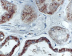 BIK Antibody - Formalin-fixed, paraffin-embedded tissue section of human kidney stained for Bik expression using Polyclonal Antibody to Bik at 1:2000. A high level of Bik signal was seen in the distal collecting tubules, the glomeruli are primarily negative. Hematoxylin-Eosin counterstain.