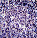 BIRC3 / cIAP2 Antibody - BIRC3 Antibody immunohistochemistry of formalin-fixed and paraffin-embedded human tonsil tissue followed by peroxidase-conjugated secondary antibody and DAB staining.