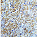 BIRC5 / Survivin Antibody - Immunohistochemistry of Survivin in mouse brain tissue with Survivin Antibodyat 5 µg/mL.