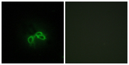 BLCAP Antibody - Immunofluorescence analysis of NIH/3T3 cells, using BLCAP Antibody. The picture on the right is blocked with the synthesized peptide.