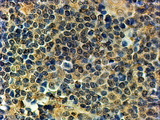 BLIMP1 / PRDM1 Antibody - Goat Anti-PRDM1 / BLIMP1 Antibody (2µg/ml) staining of paraffin embedded Human Tonsil. Steamed antigen retrieval with Tris/EDTA buffer pH 9, HRP-staining. This data is from a previous batch, not on sale.
