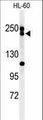 BLM Antibody - Western blot of BLM Antibody in HL-60 cell line lysates (35 ug/lane). BLM (arrow) was detected using the purified antibody.