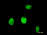 BLM Antibody - Immunofluorescence of monoclonal antibody to BLM on HeLa cell . [antibody concentration 10 ug/ml]