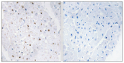 BLM Antibody - Immunohistochemistry analysis of paraffin-embedded human heart, using Bloom Syndrome (Phospho-Thr99) Antibody. The picture on the right is blocked with the phospho peptide.
