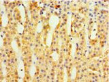 BM022 / MRPL1 Antibody - Immunohistochemistry of paraffin-embedded human adrenal gland using antibody at 1:100 dilution.  This image was taken for the unconjugated form of this product. Other forms have not been tested.