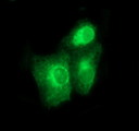 BMP1 Antibody - Anti-BMP1 mouse monoclonal antibody immunofluorescent staining of COS7 cells transiently transfected by pCMV6-ENTRY BMP1.