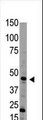 BMP15 Antibody - Western blot of anti-Bmp15 Antibody in HL60 cell line lysate (35 ug/lane). Bmp15(arrow) was detected using the purified antibody.