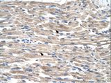 BMP2K / BIKE Antibody - BMP2K antibody BMP2K(BMP2 inducible kinase) Antibody was used in IHC to stain formalin-fixed, paraffin-embedded human muscle.  This image was taken for the unconjugated form of this product. Other forms have not been tested.