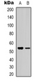 BMP3 Antibody - Western blot analysis of BMP3A expression in HEK293T (A); Jurkat (B) whole cell lysates.