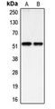BMP3 Antibody - Western blot analysis of BMP3A expression in HEK293T (A); HUVEC (B) whole cell lysates.