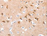 BMP4 Antibody - Immunohistochemistry of paraffin-embedded Human brain using BMP4 Polyclonal Antibody at dilution of 1:25.
