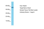 BMP5 Antibody -  This image was taken for the unconjugated form of this product. Other forms have not been tested.