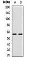 BMP6 Antibody - Western blot analysis of BMP6 expression in K562 (A); Saos2 (B) whole cell lysates.