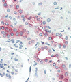 BMPR2 Antibody - Formalin-fixed and paraffin-embedded human Kidney tissue reacted with BMPR2 antibody , which was peroxidase-conjugated to the secondary antibody, followed by AEC staining. This data demonstrates the use of this antibody for immunohistochemistry; clinical relevance has not been evaluated.