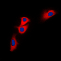 BNIP2 Antibody - Immunofluorescent analysis of BNIP2 staining in HEK293T cells. Formalin-fixed cells were permeabilized with 0.1% Triton X-100 in TBS for 5-10 minutes and blocked with 3% BSA-PBS for 30 minutes at room temperature. Cells were probed with the primary antibody in 3% BSA-PBS and incubated overnight at 4 C in a humidified chamber. Cells were washed with PBST and incubated with a DyLight 594-conjugated secondary antibody (red) in PBS at room temperature in the dark. DAPI was used to stain the cell nuclei (blue).