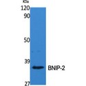 BNIP2 Antibody - Western blot of BNIP-2 antibody