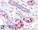 BOD1L1 / BOD1L Antibody - Human Skin, Sweat Glands: Formalin-Fixed, Paraffin-Embedded (FFPE)