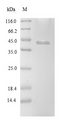 clpP2 Protein - (Tris-Glycine gel) Discontinuous SDS-PAGE (reduced) with 5% enrichment gel and 15% separation gel.