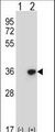 BP1 / DLX4 Antibody - Western blot of DLX4 (arrow) using rabbit polyclonal DLX4 Antibody. 293 cell lysates (2 ug/lane) either nontransfected (Lane 1) or transiently transfected (Lane 2) with the DLX4 gene.