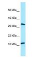 BPY2 Antibody - BPY2 antibody Western Blot of HepG2.  This image was taken for the unconjugated form of this product. Other forms have not been tested.