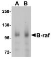 BRAF / B-Raf Antibody - Western blot analysis of B-raf in human brain tissue lysate with B-raf antibody at (A) 1 and (B) 2 ug/ml.