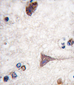 BRAF / B-Raf Antibody - Formalin-fixed and paraffin-embedded human brain tissue reacted with BRAF-pT400, which was peroxidase-conjugated to the secondary antibody, followed by DAB staining. This data demonstrates the use of this antibody for immunohistochemistry; clinical relevance has not been evaluated.