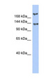 BRCA1 Antibody - BRCA1 antibody Western blot of Fetal Small Intestine lysate. This image was taken for the unconjugated form of this product. Other forms have not been tested.
