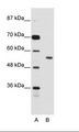 BRD3 Antibody - A: Marker, B: Jurkat Cell Lysate.  This image was taken for the unconjugated form of this product. Other forms have not been tested.