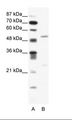 BRD9 Antibody - A: Marker, B: Jurkat Cell Lysate.  This image was taken for the unconjugated form of this product. Other forms have not been tested.