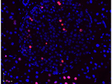BrdU Antibody - Immunofluorescence microscopy images of paraformaldehyde-fixed, paraffin-embedded pancreas sections stained with antibodies against BrdU (red or pink) and counterstained with DAPI (blue) and imaged with a 40 objective. DAPI stained nuclei (blue) indicate non-dividing cells, immunostained red and pink nuclei indicate actively dividing pancreatic -cells. The antibodies were diluted to 2.7 g/ml. and incubated with tissue sections overnight at 4 degrees. Donkey anti-rabbit secondary antibody was diluted 1:2500.