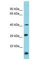 BRICD5 Antibody - BRICD5 antibody Western Blot of THP-1. Antibody dilution: 1 ug/ml.  This image was taken for the unconjugated form of this product. Other forms have not been tested.