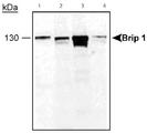 BRIP1 / BACH1 Antibody - Brip 1 detected in cell lysates. Lane 1: MCF-7 lysate, Lane 2: HeLa lysate, Lane 3:293 lysate and Lane 4: SKOV3 lysate.