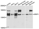BRIP1 / BACH1 Antibody - Western blot analysis of extracts of various cells.
