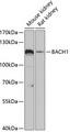 BRIP1 / BACH1 Antibody - Western blot analysis of extracts of various cell lines using BACH1 Polyclonal Antibody at dilution of 1:3000.