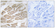 BRP44L Antibody - Immunohistochemistry analysis of paraffin-embedded human heart tissue, using BRP44L Antibody. The picture on the right is blocked with the synthesized peptide.