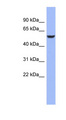 BRUNOL4 / CELF4 Antibody - CELF4 / BRUNOL4 antibody Western blot of OVCAR-3 cell lysate. This image was taken for the unconjugated form of this product. Other forms have not been tested.