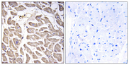 BRWD3 Antibody - Immunohistochemistry analysis of paraffin-embedded human heart tissue, using BRWD3 Antibody. The picture on the right is blocked with the synthesized peptide.
