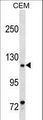 BSAC / MKL1 Antibody - MKL1 Antibody western blot of CEM cell line lysates (35 ug/lane). The MKL1 antibody detected the MKL1 protein (arrow).