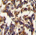 BSCL2 Antibody - BSCL2 Antibody immunohistochemistry of formalin-fixed and paraffin-embedded human testis carcinoma followed by peroxidase-conjugated secondary antibody and DAB staining.
