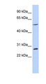 BTBD2 Antibody - BTBD2 antibody Western blot of MCF7 cell lysate. This image was taken for the unconjugated form of this product. Other forms have not been tested.
