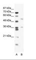 BTBD3 Antibody - A: Marker, B: Jurkat Cell Lysate.  This image was taken for the unconjugated form of this product. Other forms have not been tested.